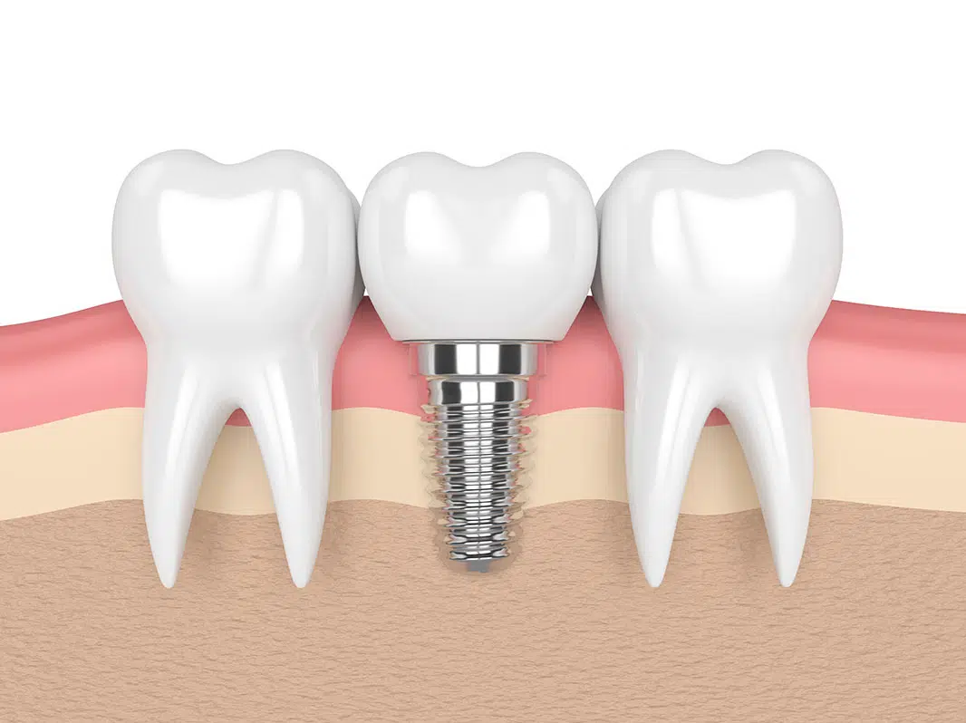 Dentistes en Hongrie