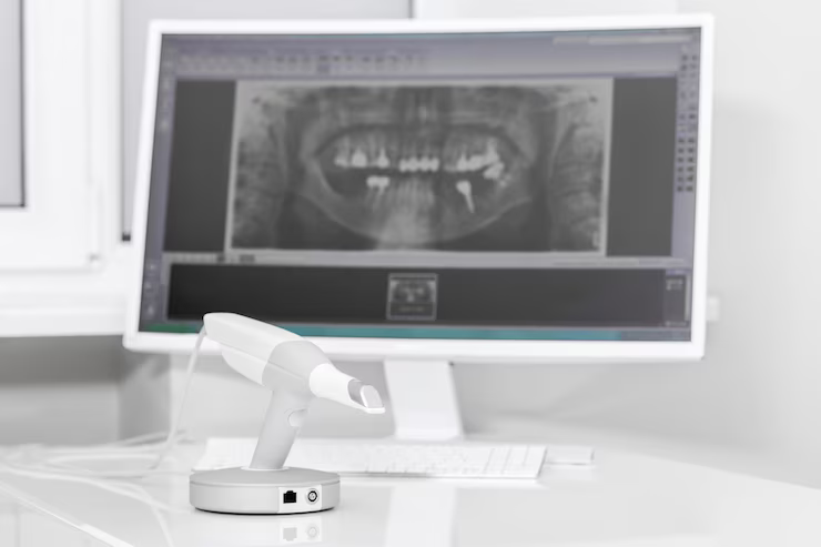 Comment comprendre le prix radio dentaire et maximiser votre remboursement ?